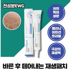 백반증커버