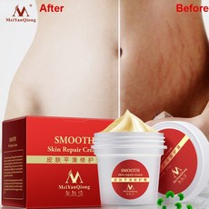 비오템튼살오일