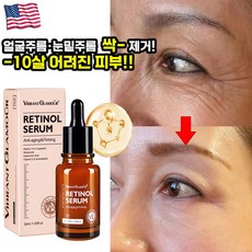 레티놀 앰플 세럼 리프팅 퍼밍 안티에이징 에센스 비타민A 원액, 5개, 30ml