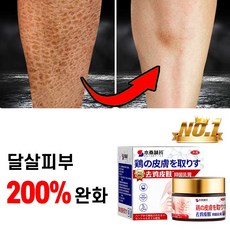 [200%완화] 일본 모공 각화증 바디로션 닭살 피부 제거 크림 뱀살 연화 보습제, 50g, 2개, 50g