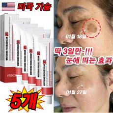 [국내 발송] 미국 기술 1+1/2+2 기미 주근깨 제거 크림 멜라토닝 크림 잡티 검버섯 제거 미백 크림 색소침착/효과보장!!