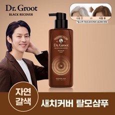 lg탈모