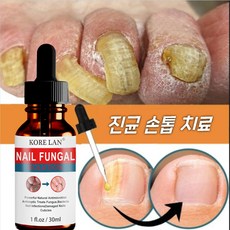 KORELAN 발톱무좀치료 발톱무좀약 발톱무좀연고 발무좀연고 리페어 에센스, 30ml, 2개