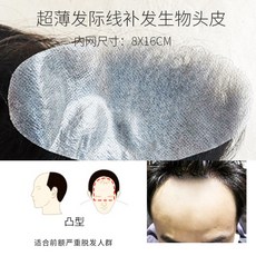 엠라인헤어패치