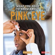 What You Need to Know about Pink Eye Hardcover, Capstone Press