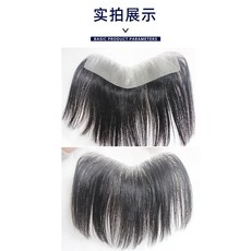 남자m자패치