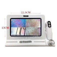 모낭진단현미경 두피모발확대경 탈모피부진단기 디지털분석기 고배율전자돋보기 헤어테스터