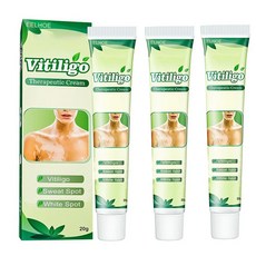 백반증 치료 연고 손 목 몸 얼굴 연피부 백반증치료 vitiligo cream