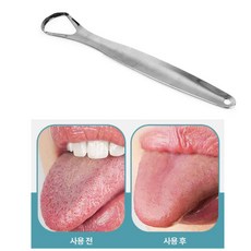 백태 없애는 입냄새 구강 스텐 클리너 혀클리너스텐, 1개