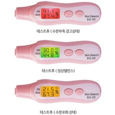 피부진단기