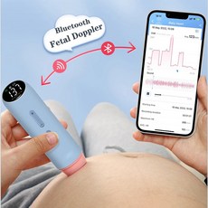 태아심음측정기 태아도플러 USB 심장 모니터링 블루투스 50 충전식 임산부 모니터 앱 사운드 저장 공유, 1개