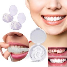 가짜 이빨 식품급 치아미백 수리 (포장 증정), 2개(1+1)