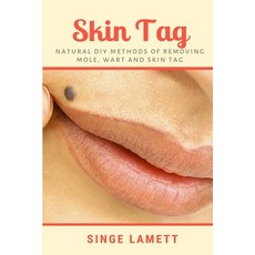 Skin Tag: Natural DIY Methods of removing Mole Wart and Skin Tag Paperback, Lulu.com, English, 9781794811737