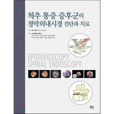 척추통증움직임문제