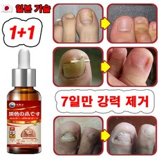 [효과보장] 일본 1/1+1 손톱 발톱 무좀 영양제 앰플 네일 케어 에센스 문제성 손 발톱 관리, 2개, 30ml - 히트필