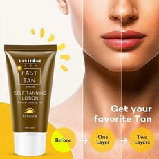 오스트레일리안골드선레스