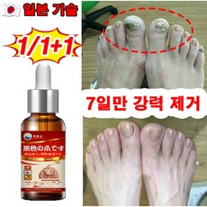 [효과보장] 일본 1/1+1 손톱 발톱 무좀 영양제 앰플 네일 케어 에센스 문제성 손 발톱 관리