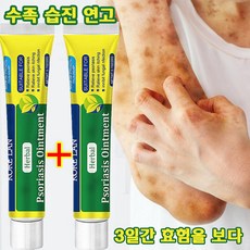 (본토출하)Herbal 1 1 피부 가려움증 한포진 습진 피부건조 알레르기 발포 습진 등의 증상 완화 연고