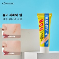 흉터 복원 흉터 제거 피부 재생 흉터 복원 및 완화, 4개, GH04
