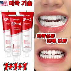 미국 SP4 1+1/2+2 고불소 미백 치약 프로바이오틱 치약 화이트닝 잇몸붓기 염증 예방 구취케어 치약, 3개, 120g