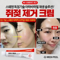 얼굴비립종제거
