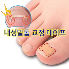 발관리 내성발톱 발톱관리 발톱 교정 밴드 10p 1장