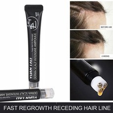 헤어 라인 성장 세럼 더마 두피 앰플 트리플 롤 마사지 패스트 리grow 탈모 에센스, 01 20ml, 1개, 20ml