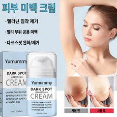 바디미백 겨드랑이미백 팔꿈치미백 Y존미백 멜라닌제거, 4개, GH09