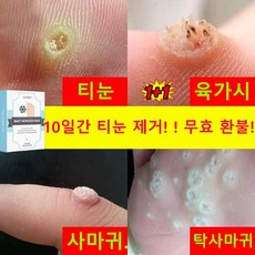 [국내배송] 티눈 밴드 티눈제거 밴드 보호테이프 발바닥 통증 풋케어, 4개