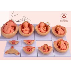 태아 배아 발달 모형 산부인과 교육 자궁, 기본 모델, 1개