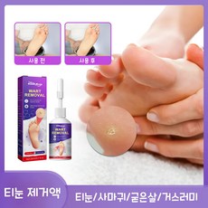 애프터티눈셋트