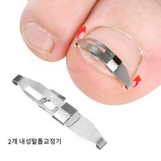[독일제] 내성발톱교정기 4종 세트 라텍스 내성발톱교정기 내향성발톱 자가치료