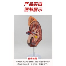 의료용마네킹 한의대 인체 신장기관 의료용 해부교구 생식비뇨기과 신장내과 신장 전시구조