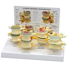 다양한 단계의 GPI Anatomicals 1760 척추 모델, 단일옵션, 단일옵션