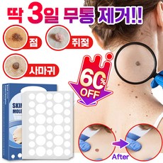 [빠른배송] 피부 제거 패치 얼굴 바디 피부 치료 라벨 스텔스 포장증정, 145매입, 2개, 145매입