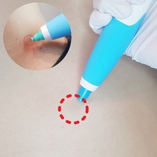 떨어젖 제거기 겨드랑이 목 피부 사타구니 어깨 몸 셀프 제거기, 반자동, 1개