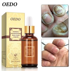 opi큐티클오일펜