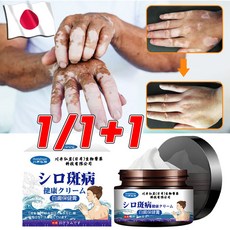 일본 1+1/2+2 백반증 연고 반점제거 손 목 얼굴 백반증치료
