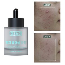 세범리밸런싱 앰플 지성피부 관리 피지 녹이는 제품 피지 분비 억제 여드름 앰플 피부 결 개선 트러블 진정 히알루론산 수분 세럼