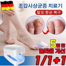 미국기술 1/1+1 가정용 손발 발톱 무좀 레이저 문제성 곰팡이제거 홈케어 관리 기기 네일레이저