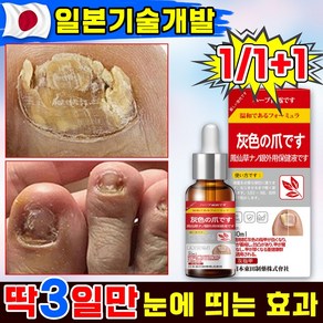 [빠른배송] 일본 손발톱 영양제 문제성발톱 발톱 연화제 앰플 네일 리페어 곰팡이 개선, 2개, 29.99ml