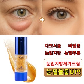 눈밑지방제거 눈밑꺼짐 다크서클 눈밑지방 눈밑주름 아이백크림 눈밑지방 아이백 유쎄라블 리프팅 다크서클 눈밑꺼짐 눈밑주름 눈밑지방제거 비립종제거 아이크림, 2개, 30ml