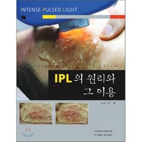 IPL의 원리와 그 이용, 이욱 저, 엠디월드