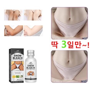 멜라논크림 멜라토닝크림 겨드랑이 색소침착 색소침착연고 멜라닌 억제