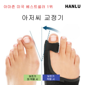 HANLU [속달 발송] 볼구스 발가락 링 포그니 발가락 벌림 남여공용 엄지발찌 보호대 발찌/라라무브 엄지발가락 분리 고정밴드 보호대 좌우/무지외반증 교정기, 2개