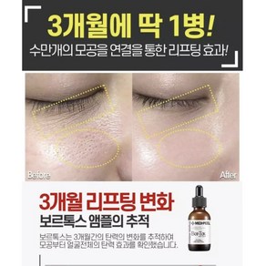 보르피린 앰플 또는 크림/주름 모공 이상적인조합 보르피린후기 보르피린성분 브이라인 리프팅, 1개