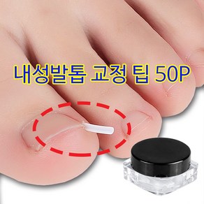 더로만 문제성 발톱 교정팁