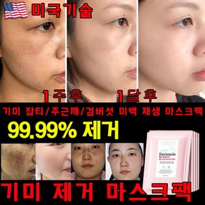 [3일만의 효과] 기미패치 기미 잡티 주근깨 검버섯 점 빼기 색소침착 미백 재생 마스크팩 멜라닌 제거 패치, 5개, 5개입