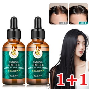 헤어 성장 오일 진저 모발 촉진 & 탈모 예방 모근 강화 트리트먼트, 3개, 30ml