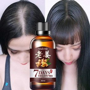 양말. 모발 성장 재성장 생강 세럼 오일 손실 방지 트리트먼트 30ml